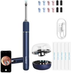 BEBIRD Note 5 Pro – smart otoscope with camera (blue)